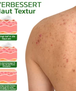 GFOUK™ BodyTreat Kollagen-Peeling-Essenz