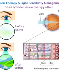 GFOUK™ Eye Therapy Patch