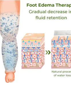 GFOUK™ Foot Edema Therapy Patch