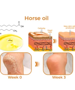 GFOUK™ Horse Oil Foot Callus Remedy Balm