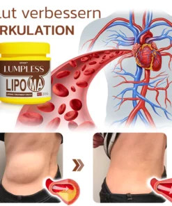 GFOUK™ Lumpless Lipom-Behandlungscreme