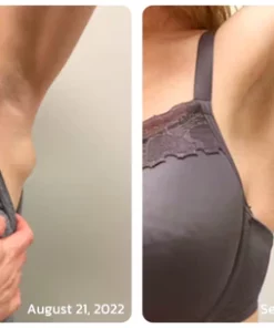 GFOUK™ Lumpless Lipom-Behandlungscreme