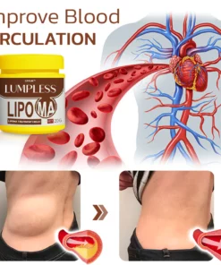 GFOUK™ Lumpless Lipoma Treatment Cream