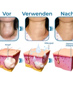 GFOUK™ Nackenkropf-und Straffungstherapie-Serum