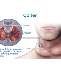 GFOUK™ Neck Goiter and Firming Therapy Serum