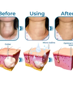 GFOUK™ Neck Goiter and Firming Therapy Serum
