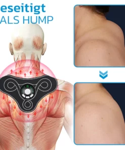 GFOUK™ TENSTECH Akupunkturpunkte Lymphatische Beruhigung Hals Instrument