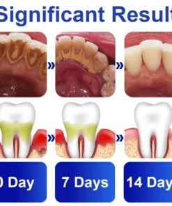 GFOUK™️ PureSmile Essence