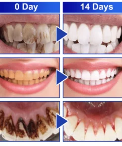 GFOUK™️ PureSmile Essence