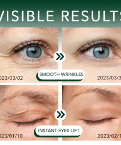 GLODIANT™ Renew Peptide Lifting Eye Gel