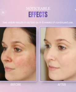 IceLuxe™ Perilla Ice Crystal Moisturizing Gel