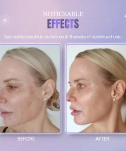 IceLuxe™ Perilla Ice Crystal Moisturizing Gel