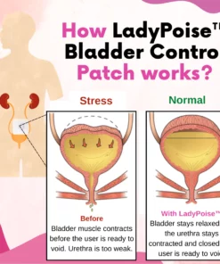 LadyPoise™ Bladder Control Patch