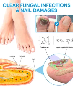 Liacsy™ AdvanceLight FootFix Device