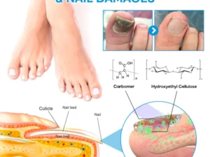 Liacsy™ AdvanceLight FootFix Device