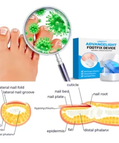 Liacsy™ AdvanceLight FootFix Device