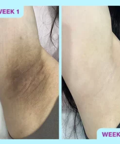 Liacsy™ DynamicGlow Exfoliërende Pads