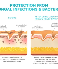 Liacsy™ Privato Relief Spray