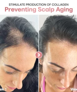 Liascy™ ProRevita Rice Nutri Spray