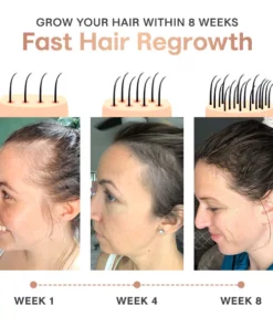 Liascy™ Ricense Hair Scrub