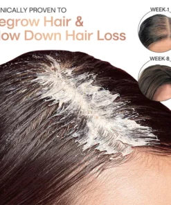 Liascy™ Ricense Hair Scrub