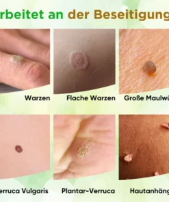 Luméa™ Hauttag-Entferner Seife