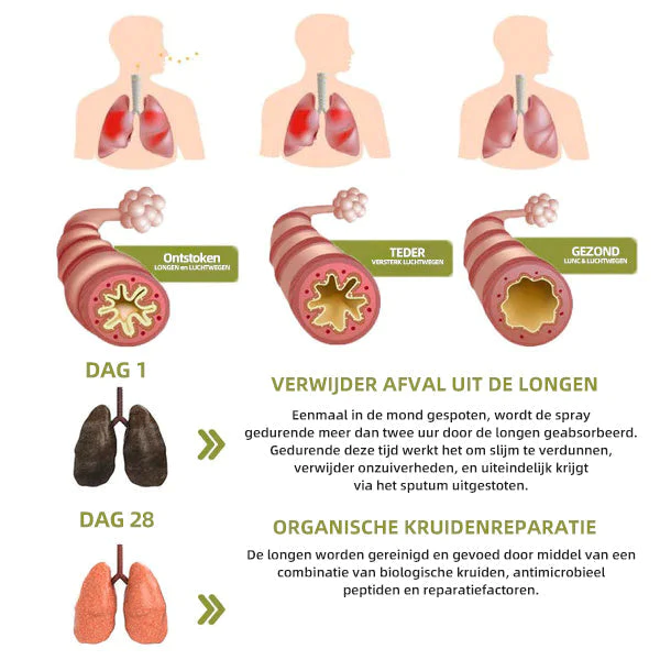 LungGuard™ BreatheWellnatuurlijke kruidenspray kwa muda mrefu katika demhalingsondersteuning