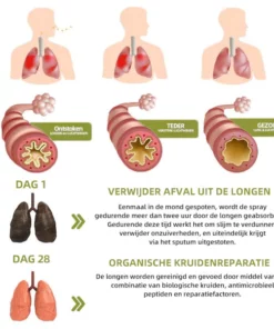 LungGuard™ BreatheWellnatuurlijke kruidenspray voor long-en ademhalingsondersteuning