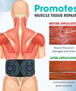 MedPlus™ Acupressure Back Relief Belt