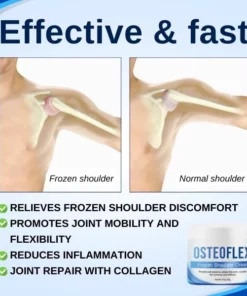 OsteoFlex™ Frozen Shoulder Cream