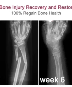 Ourlyard ™ Gelenk- und Knochentherapie-Creme