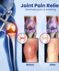 Ourlyard™ Gelenk- und Knochenreparatur-Gelroller