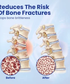 Ourlyard™ Gelenk- und Knochenreparatur-Gelroller