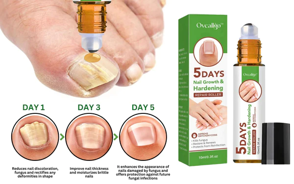Amazon.com : 5 Days Nail Growth and Hardening Repair Roller,Nail Repair  Essence,Nail Growth and Strengthening Serum,Nail Care Roller Balls，Toenail  Growth Essence (3pcs) : Beauty & Personal Care