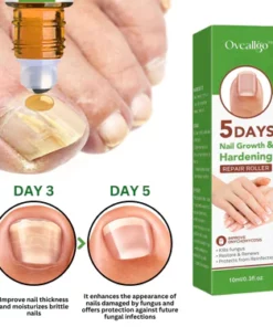 Oveallgo™ 5 Days Nail Growth and Hardening Repair Roller