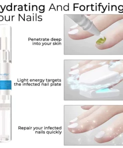 Oveallgo™ Dispositivo terapéutico con láser para limpieza de hongos y uñas