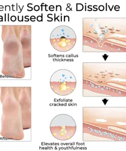 Oveallgo™ Horse Oil Foot Callus Remedy Balm