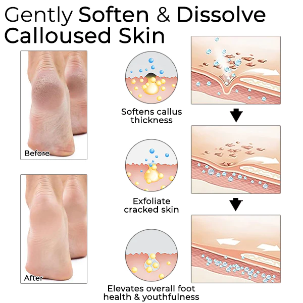 Oveallgo™ Horse Oil Foot Callus Remedy Balm