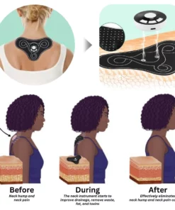 Oveallgo™ Instrumento Cervical LymphoSoothe con Acupuntura TENSWave