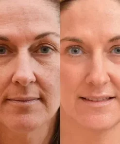 Oveallgo™ Korean Taro Peptide Deer Bone Soluble Collagen Membrane