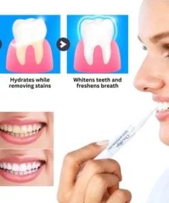 Oveallgo™ Medical-Grade Teeth Whitening Serum Pen