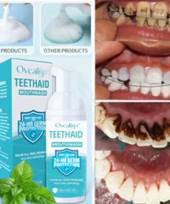 Oveallgo™ Mousse de Limpieza Oral Intensiva para Eliminar Manchas