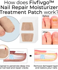 Oveallgo™ Nail Repair Moisturizer Treatment Patch