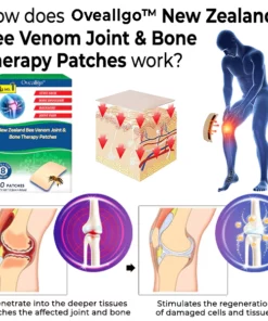Oveallgo™ New Zealand Bee Venom Joint & Bone Therapy Patches