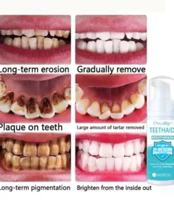 Oveallgo™ PRO Intensive Stain Removal Oral Cleansing Mousse
