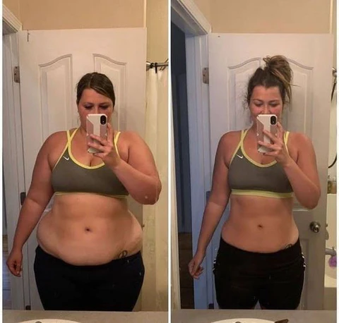 Oveallgo™ Slim Extreme 4D Scalpel Super calorie torching Serum