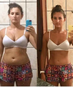 Oveallgo™ Slim Extreme 4D Scalpel Super calorie torching Serum