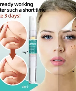 Oveallgo™ Tags & Moles Remover Pen