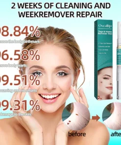 Oveallgo™ Tags & Moles Remover Pen