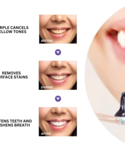 Oveallgo™ Whitening Purple Mousse Toothpaste